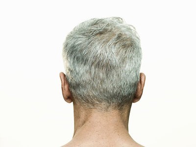 gray hair cure